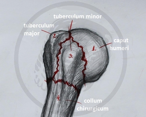 prelom vrata humerusa